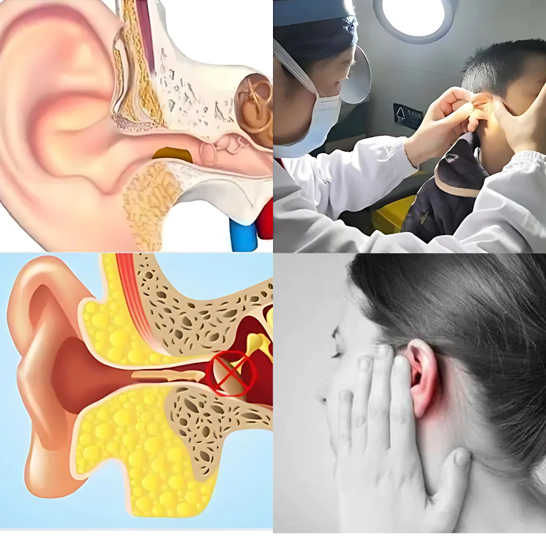 EarNova™ Wax Remover Pro (with HD camera)